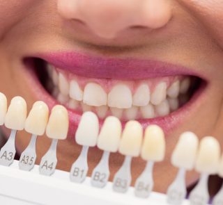 Dentist examining female patient with teeth shades at dental clinic